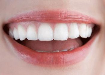 membuat gigi makin kinclong